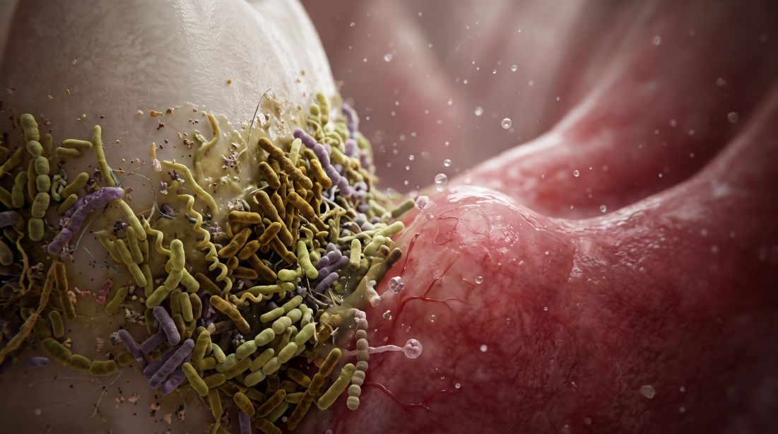 Todo lo que debes saber sobre la disbiosis oral