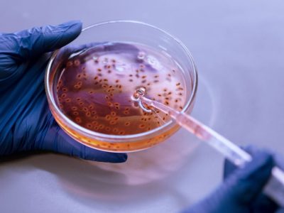 Estudiando microorganismos en una placa de Petri